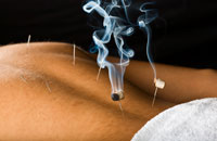 Moxibustion Slider